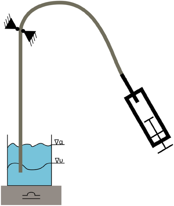 Design of percutaneous transluminal coronary angioplasty balloon catheters biomedical engineering online full text