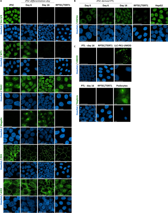 Generation and characterization of ipsc