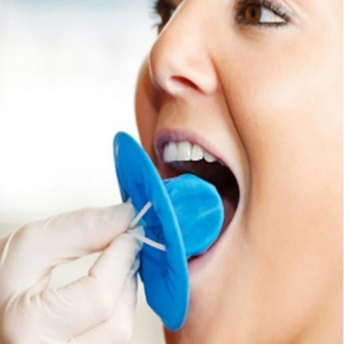 Ivoclar optradam plus refills