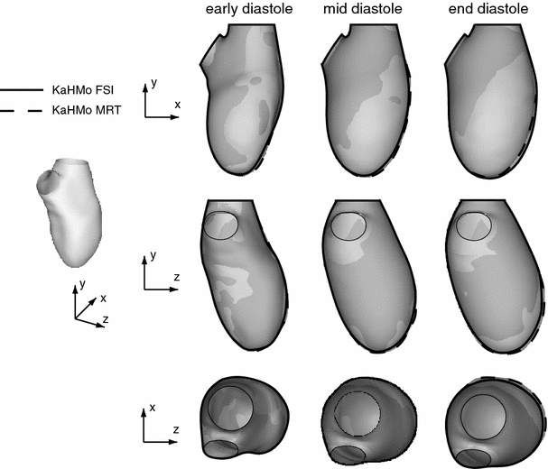 Partitioned fluidâsolid coupling for cardiovascular blood flow validation study of pressure
