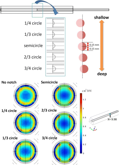 Effect of a notch at the distal end of a microcatheter on vein deformation in segmental adrenal venous sampling a preliminary study using putational fluid dynamics medical biological engineering puting