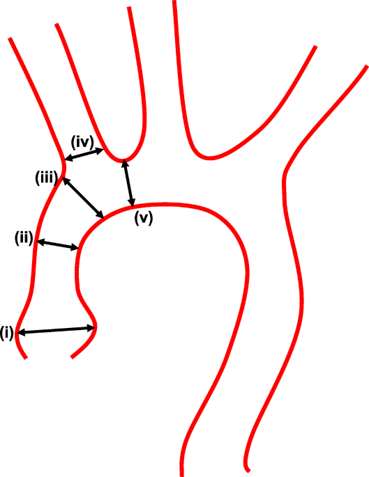 Molecular imaging of endothelial activation and mineralization in a mouse model of accelerated atherosclerosis ejnmmi research full text