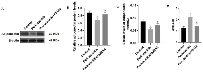 Experimental periodontitis induced hypoadiponectinemia by ireî