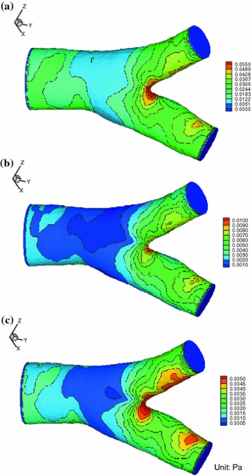 Airway wall stiffening increases peak wall shear stress a fluidâstructure interaction study in rigid and pliant airways annals of biomedical engineering
