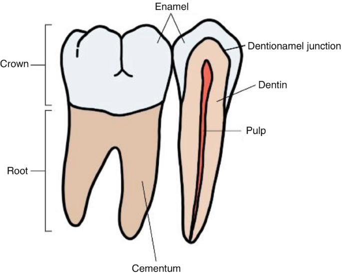 Dental caries