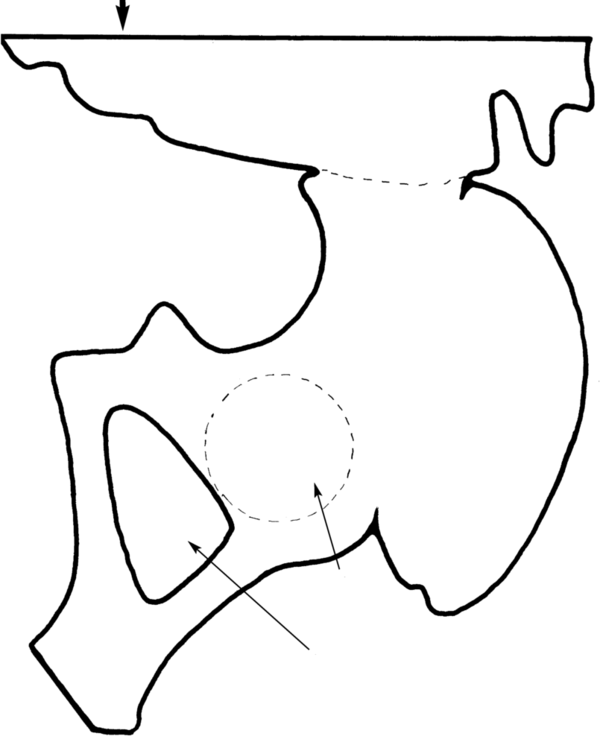Material de enseãanza