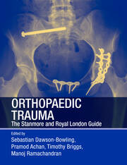 Orthopaedic trauma the stanmore and royal london guide