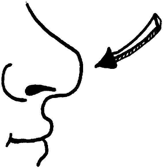 Page nose