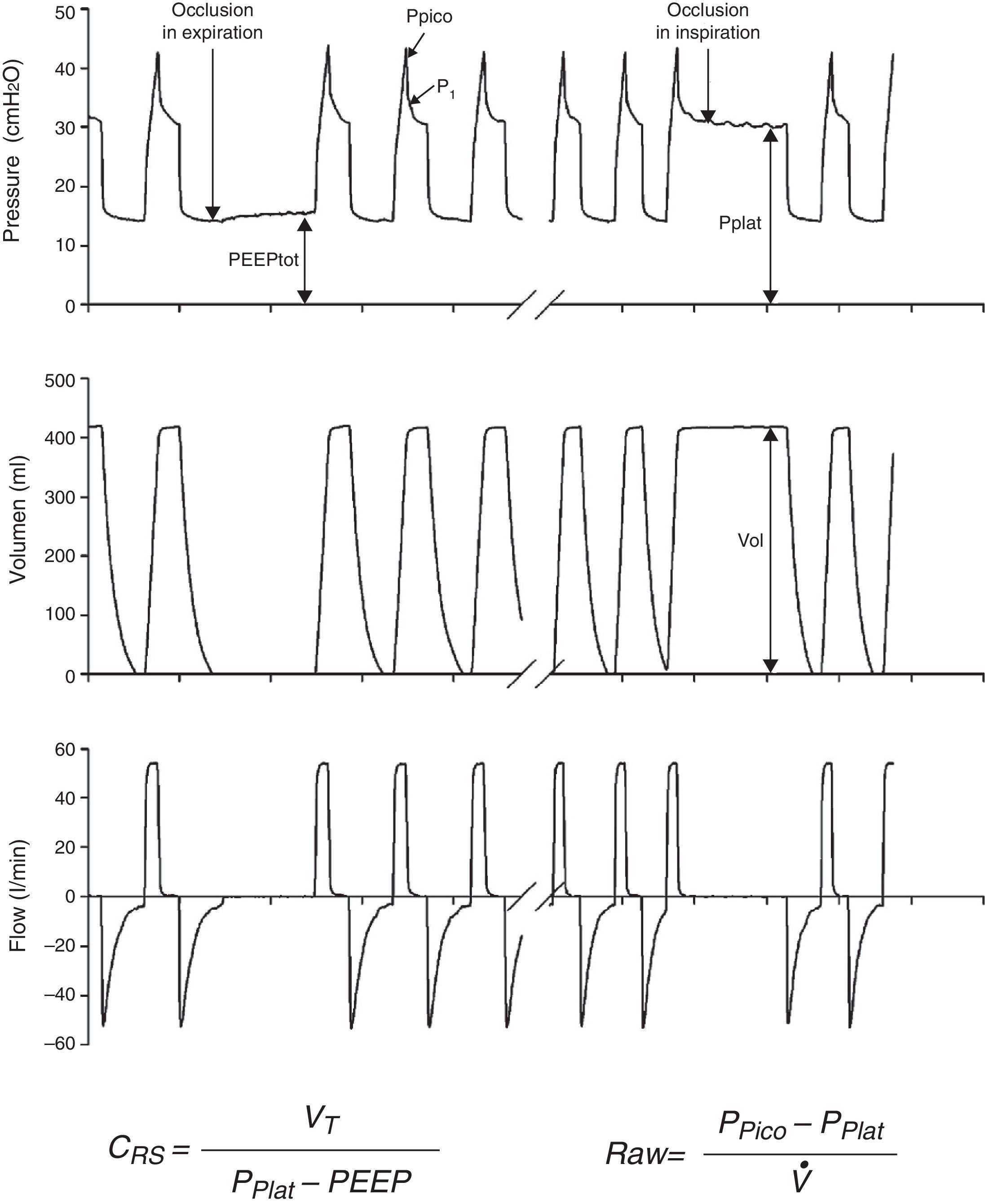Monitorization of respiratory mechanics in the ventilated patient medicina intensiva