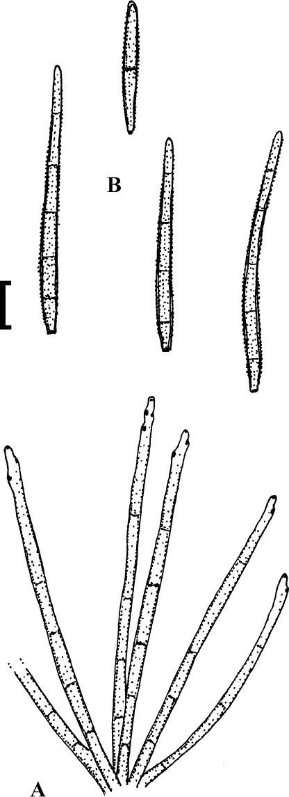 Cercosporoid fungi mycosphaerellaceae species on monocots acoraceae to xyridaceae excluding poaceae ima fungus full text