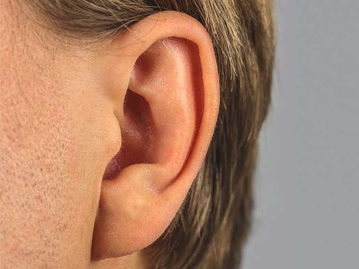 Keloid on ear piercings other causes treatment removal preve