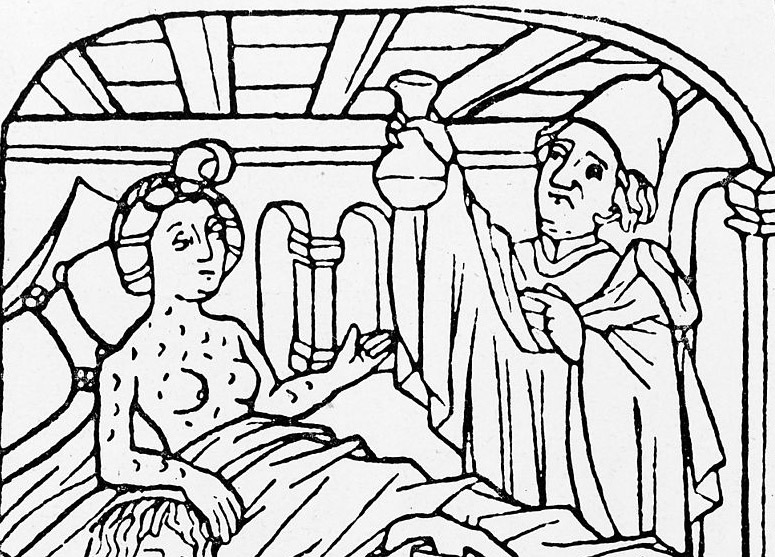 Pox and paranoia in renaissance europe history today