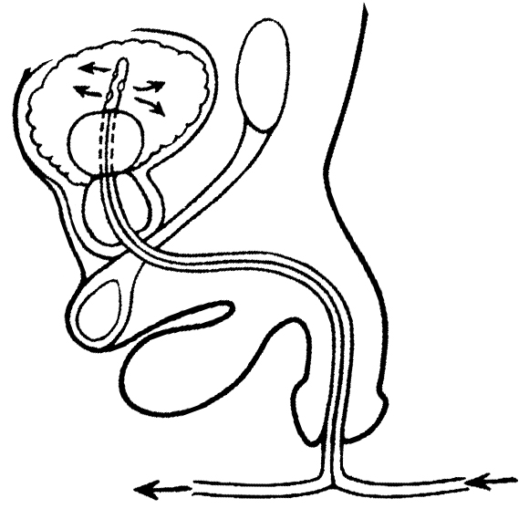 Male urinary tract with foley catheter in place to drain urine